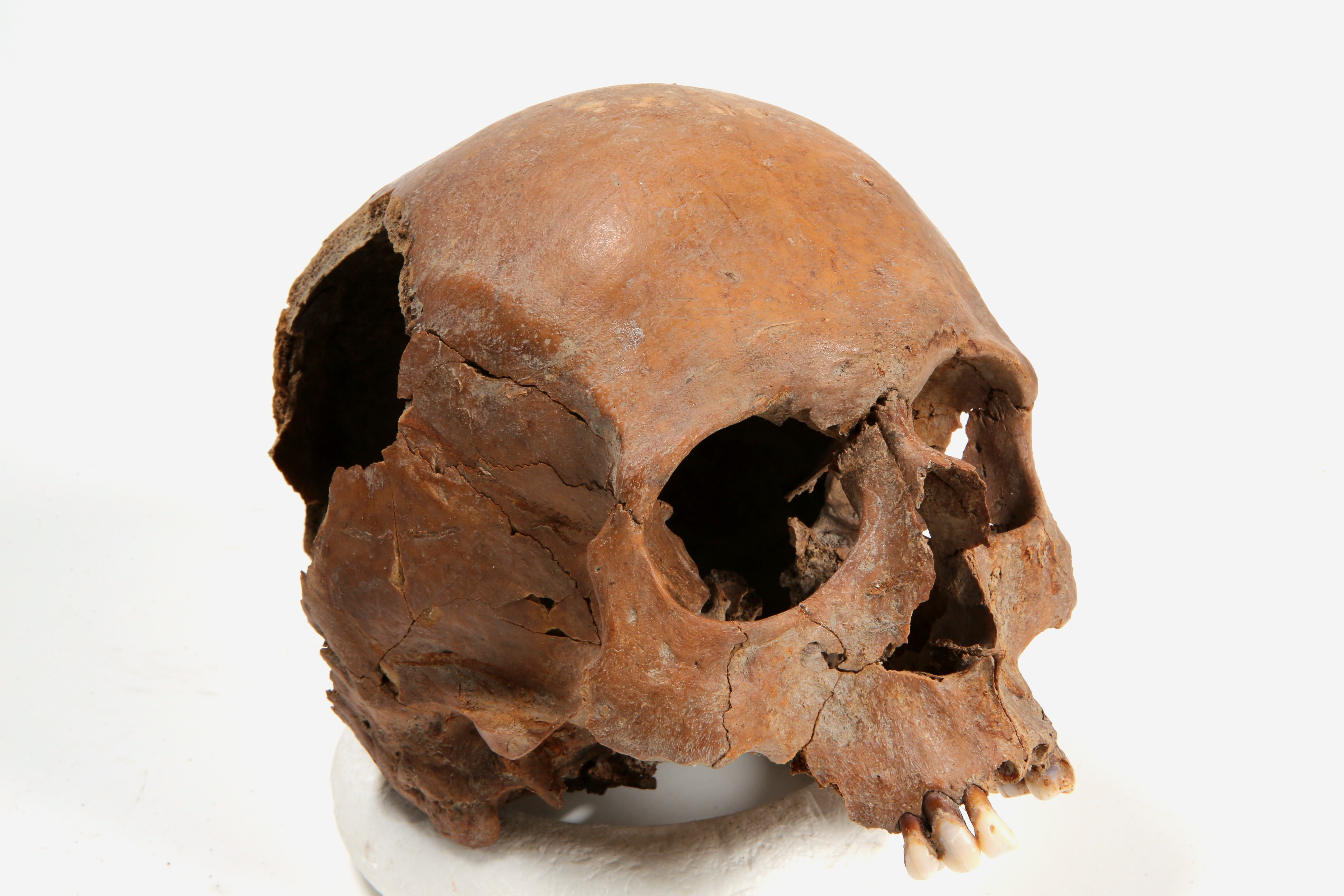 Nog een foto van  Bot, menselijk