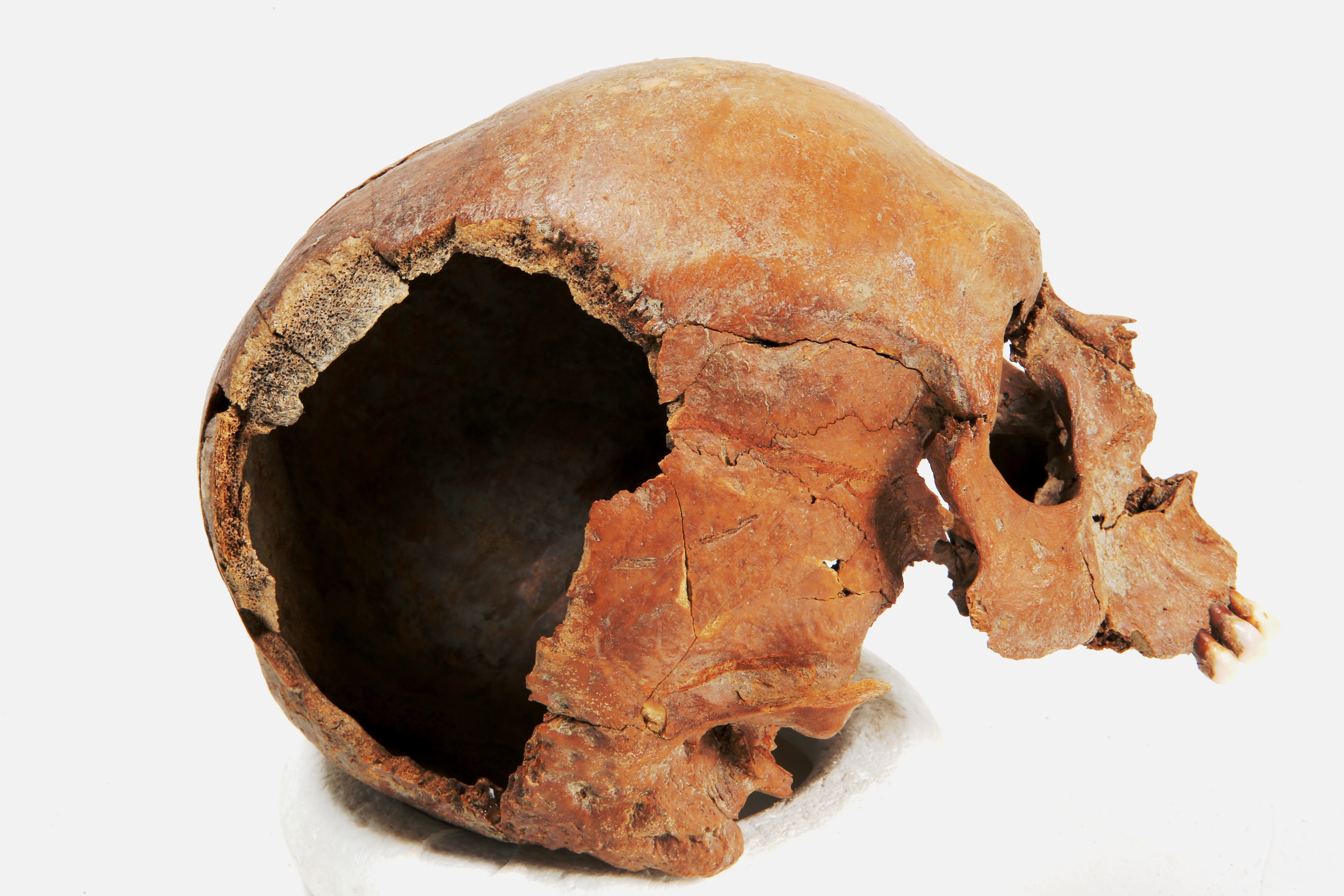 Nog een foto van  Bot, menselijk