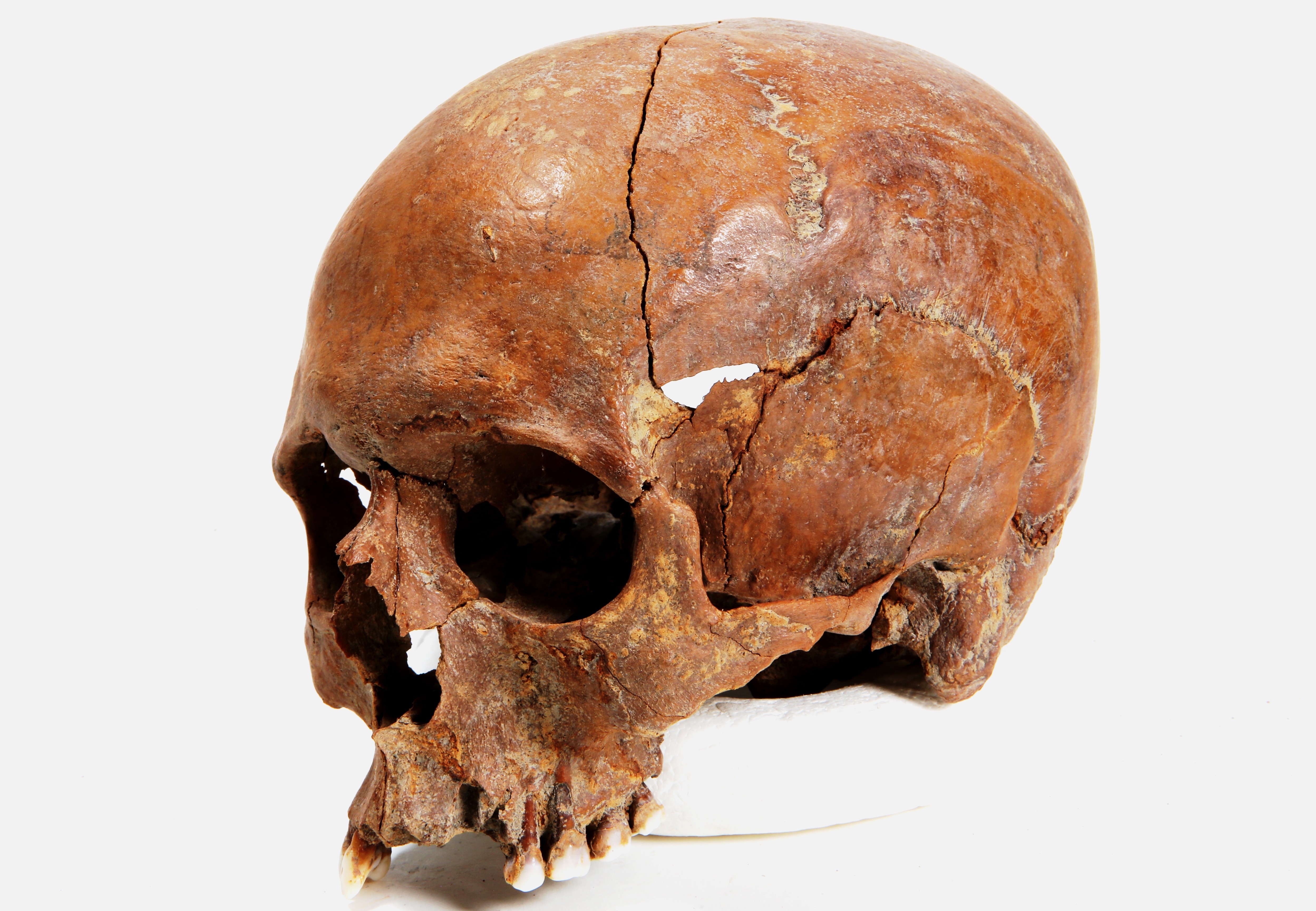 Nog een foto van  Bot, menselijk