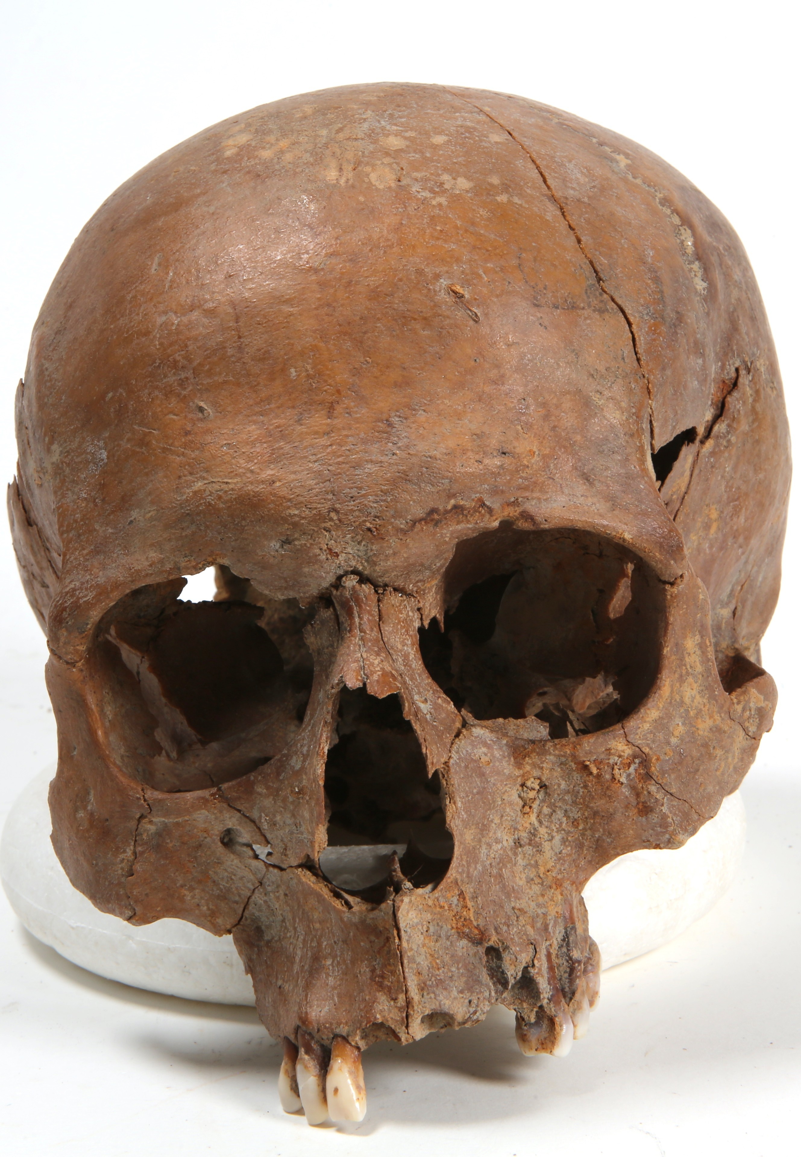 Nog een foto van  Bot, menselijk