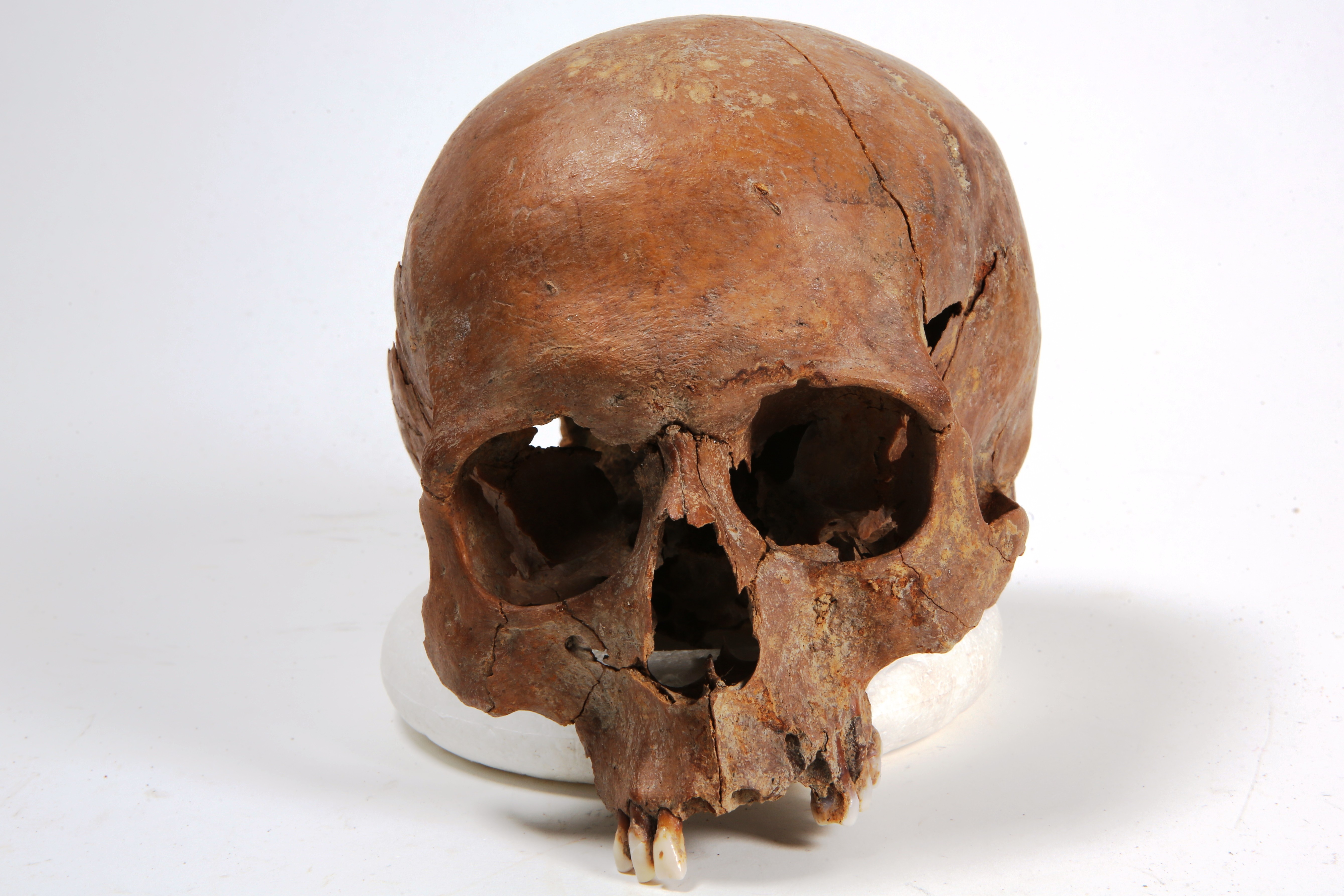 Nog een foto van  Bot, menselijk