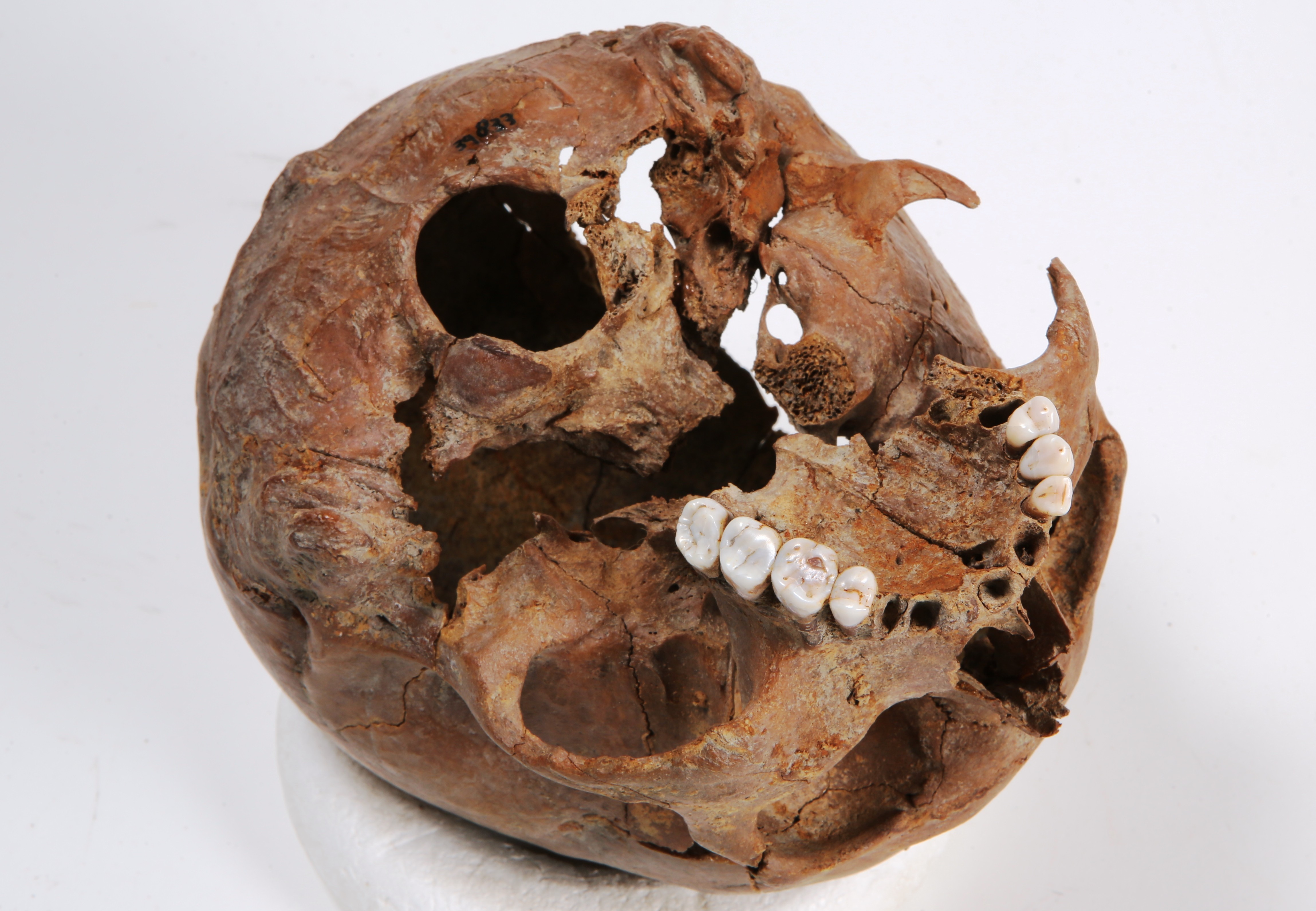 Nog een foto van  Bot, menselijk