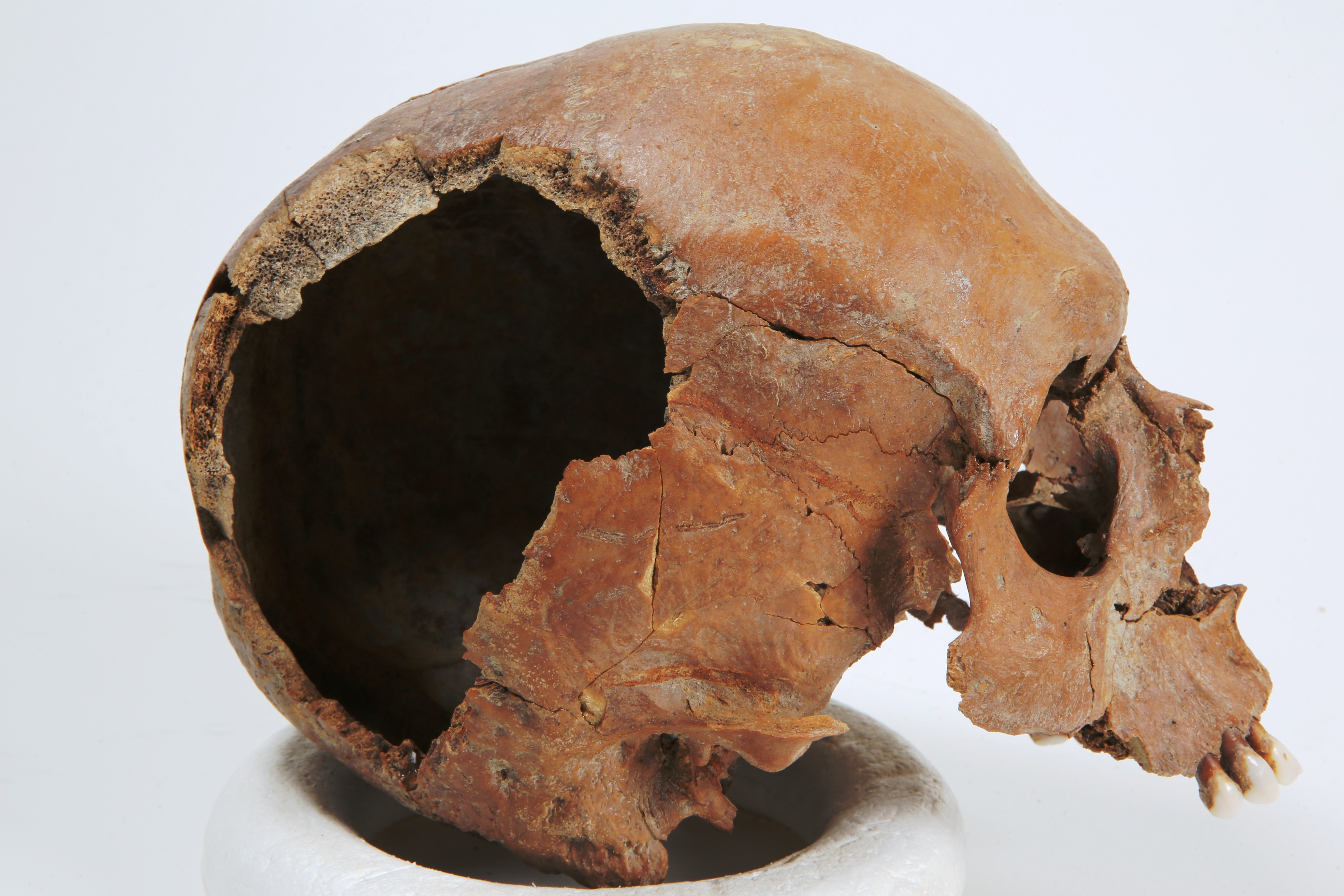 Nog een foto van  Bot, menselijk